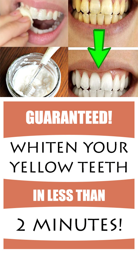 Yellow teeth are embarrassing and that makes people feel uncomfortable and less confident. People who don’t have perfectly white teeth don’t want to smile or laugh at all.