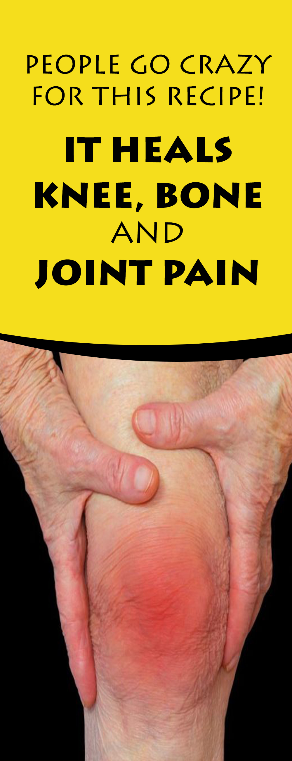 Other Name For Knee Joint