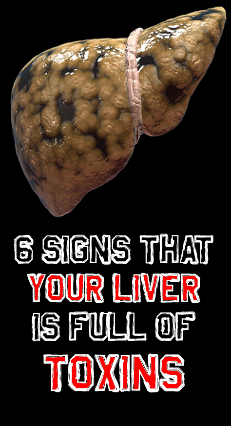 The symptoms that can indicate a livers in need of detoxification are as below: