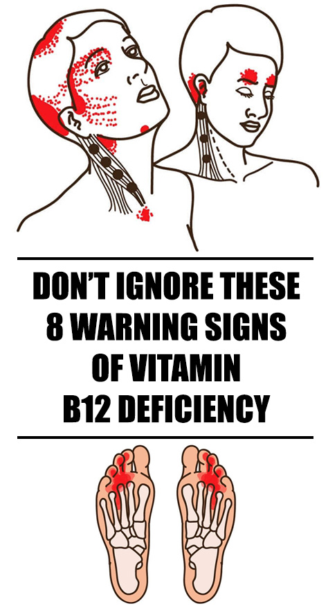 Mineral deficiencies are more common than vitamin deficiencies, statistics shows that one in four adults deals with lack of vitamin B12.