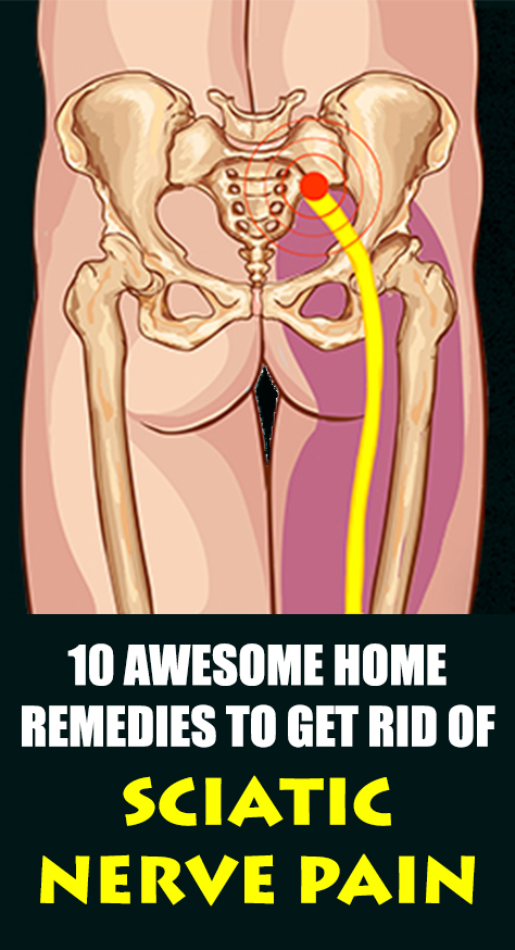 With the help of these natural therapies and home remedies, the sciatica pain disappears within six weeks.