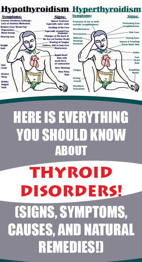 How to Prevent and Treat Thyroid Disorder Naturally: