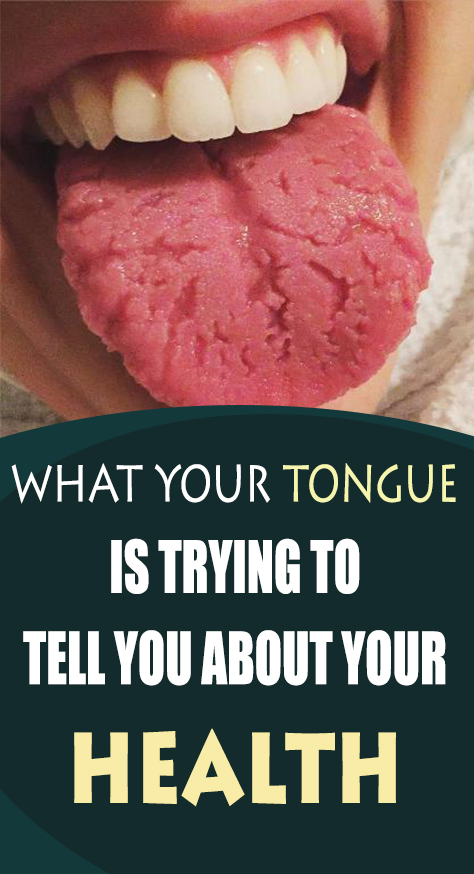 In the event that you stop and break down your tongue in the mirror, you may see signs that are side effects of some medical problems you encounter.