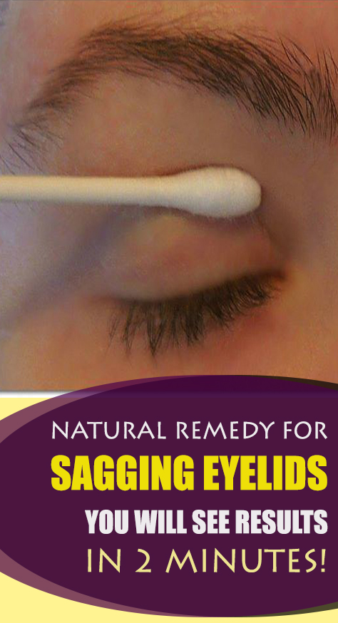 After the application of this remedy, the result will be visible in just a few minutes. Here is the recipe for the remedy to cure sagging eyelids.