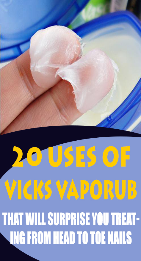 Here are 20 good reasons why you should start using Vaseline every day