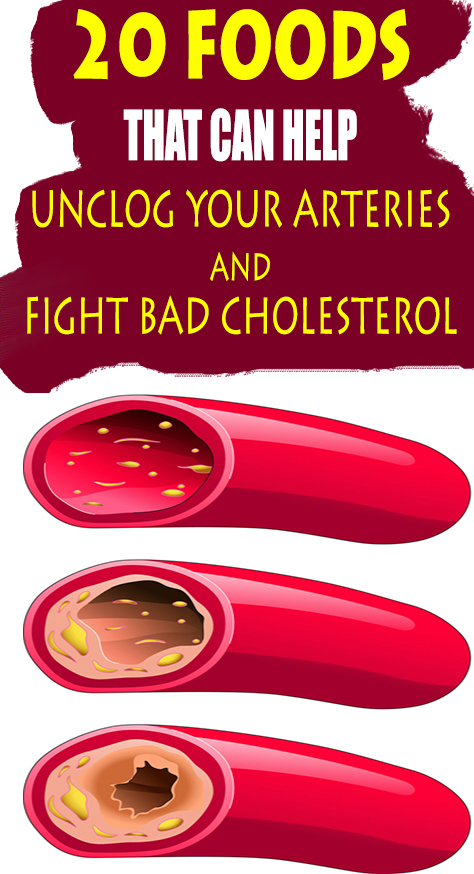 It is never too late to start eating for your arteries, due tot he fact that blockage can start very early, and science has proven that this kinds of foods may be your ticker’s best friend in order to unclog your arteries and also fight bad cholesterol.