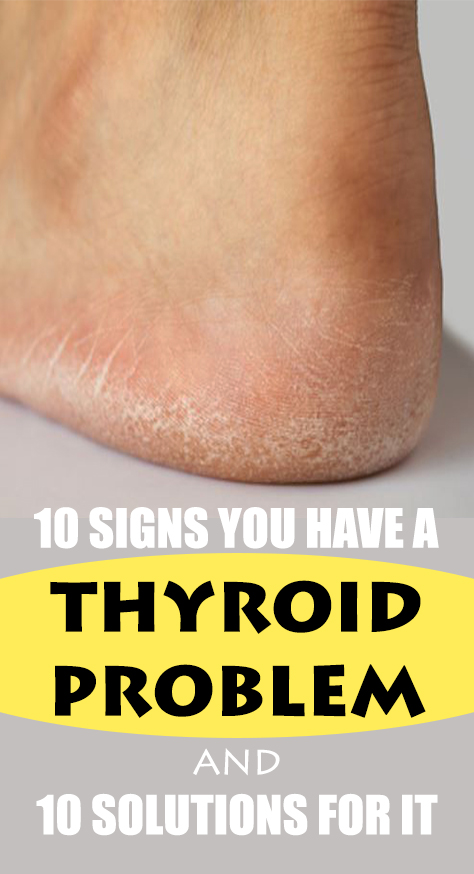 Here are 10 signs that you could have an underactive thyroid: