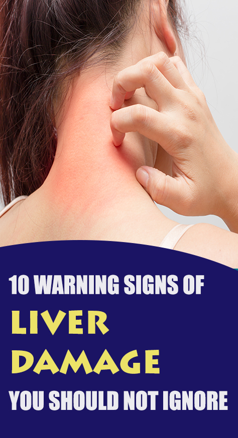 Liver damage can be potentially fatal, depending upon the severity of it. Interestingly, your body keeps warning you about it. So, why not listen to it?